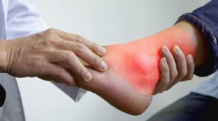 what can and can not be consumed with gout in the legs